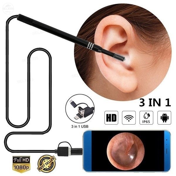 Endoscopio De Limpieza De Oídos Hd Ear Pick Cleaner 3 En 1 USB Shopee