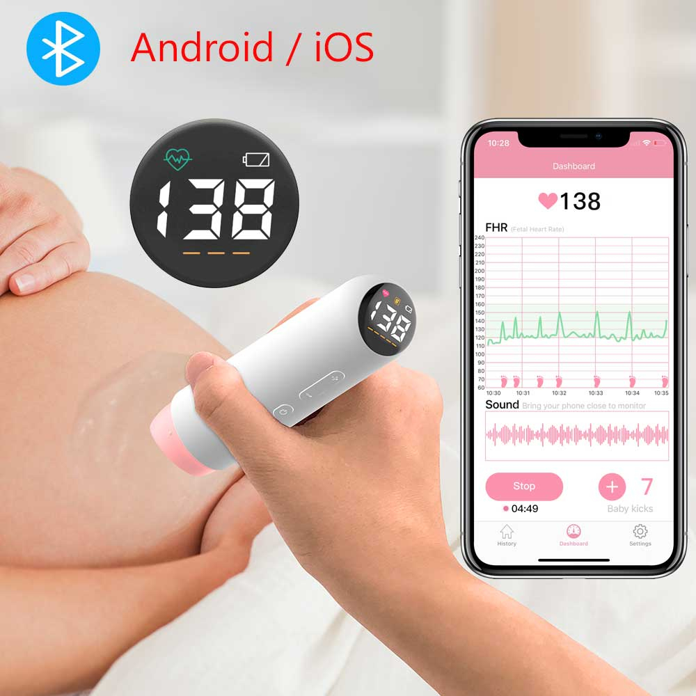 Monitor Fetal Doppler Recargable Por Bluetooth De Corazón Inteligente Para Bebés Embarazadas Grabación De Datos 0 Radiación